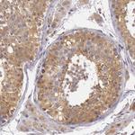 PCTAIRE1 Antibody in Immunohistochemistry (Paraffin) (IHC (P))