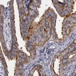 Flotillin 1 Antibody in Immunohistochemistry (Paraffin) (IHC (P))