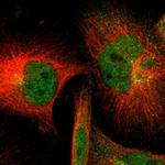 SOD1 Antibody in Immunocytochemistry (ICC/IF)