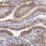 SOD1 Antibody in Immunohistochemistry (Paraffin) (IHC (P))