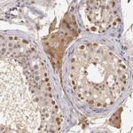 SOD1 Antibody in Immunohistochemistry (Paraffin) (IHC (P))