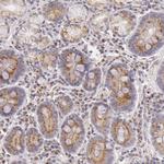 LGMN Antibody in Immunohistochemistry (Paraffin) (IHC (P))