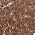 ECE1 Antibody in Immunohistochemistry (Paraffin) (IHC (P))