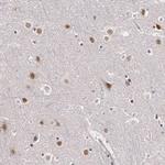 PLZF Antibody in Immunohistochemistry (Paraffin) (IHC (P))