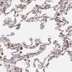 PLZF Antibody in Immunohistochemistry (Paraffin) (IHC (P))