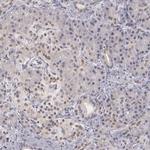 PLZF Antibody in Immunohistochemistry (Paraffin) (IHC (P))