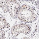 PLZF Antibody in Immunohistochemistry (Paraffin) (IHC (P))