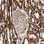 ATP Synthase beta Antibody in Immunohistochemistry (Paraffin) (IHC (P))