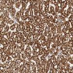 ATP Synthase beta Antibody in Immunohistochemistry (Paraffin) (IHC (P))