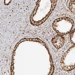 ATP Synthase beta Antibody in Immunohistochemistry (Paraffin) (IHC (P))