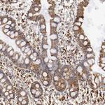 ATP Synthase beta Antibody in Immunohistochemistry (Paraffin) (IHC (P))