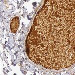 C4BPA Antibody in Immunohistochemistry (Paraffin) (IHC (P))