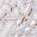 C4BPA Antibody in Immunohistochemistry (Paraffin) (IHC (P))