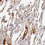 C4BPA Antibody in Immunohistochemistry (Paraffin) (IHC (P))