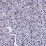 Kininogen 1 Antibody in Immunohistochemistry (Paraffin) (IHC (P))