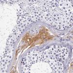 Kininogen 1 Antibody in Immunohistochemistry (Paraffin) (IHC (P))