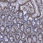 hnRNP A2B1 Antibody in Immunohistochemistry (Paraffin) (IHC (P))