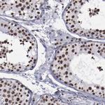 hnRNP A2B1 Antibody in Immunohistochemistry (Paraffin) (IHC (P))