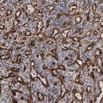 NHERF2 Antibody in Immunohistochemistry (Paraffin) (IHC (P))