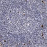 NHERF2 Antibody in Immunohistochemistry (Paraffin) (IHC (P))