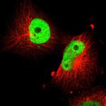 SOX9 Antibody in Immunocytochemistry (ICC/IF)