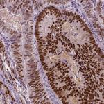 SOX9 Antibody in Immunohistochemistry (Paraffin) (IHC (P))