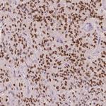 SOX9 Antibody in Immunohistochemistry (Paraffin) (IHC (P))