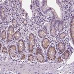 SOX9 Antibody in Immunohistochemistry (Paraffin) (IHC (P))