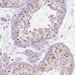 SOX9 Antibody in Immunohistochemistry (Paraffin) (IHC (P))