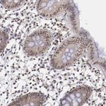 HIF-1 beta Antibody in Immunohistochemistry (Paraffin) (IHC (P))