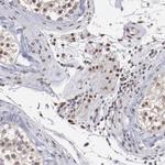 HIF-1 beta Antibody in Immunohistochemistry (Paraffin) (IHC (P))