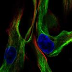 Vimentin Antibody in Immunocytochemistry (ICC/IF)