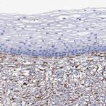 Vimentin Antibody in Immunohistochemistry (Paraffin) (IHC (P))