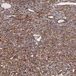 Vimentin Antibody in Immunohistochemistry (Paraffin) (IHC (P))