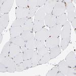 Vimentin Antibody in Immunohistochemistry (Paraffin) (IHC (P))