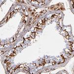 Vimentin Antibody in Immunohistochemistry (Paraffin) (IHC (P))