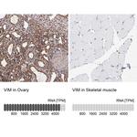 Vimentin Antibody