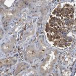 MYO1C Antibody in Immunohistochemistry (Paraffin) (IHC (P))