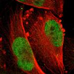 MSK1 Antibody in Immunocytochemistry (ICC/IF)