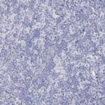 SNAP25 Antibody in Immunohistochemistry (Paraffin) (IHC (P))