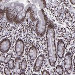 BRD8 Antibody in Immunohistochemistry (Paraffin) (IHC (P))