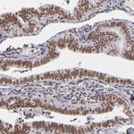 BRD8 Antibody in Immunohistochemistry (Paraffin) (IHC (P))