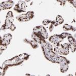 BRD8 Antibody in Immunohistochemistry (Paraffin) (IHC (P))