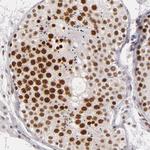 BRD8 Antibody in Immunohistochemistry (Paraffin) (IHC (P))