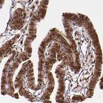 STAT6 Antibody in Immunohistochemistry (Paraffin) (IHC (P))