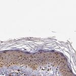 STAT6 Antibody in Immunohistochemistry (Paraffin) (IHC (P))