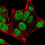 CHK2 Antibody in Immunocytochemistry (ICC/IF)