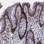 CHK2 Antibody in Immunohistochemistry (Paraffin) (IHC (P))