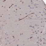 Laminin beta-2 Antibody in Immunohistochemistry (Paraffin) (IHC (P))