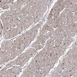 Laminin beta-2 Antibody in Immunohistochemistry (Paraffin) (IHC (P))